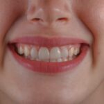 teeth whitening at home guide for a brighter-looking smile